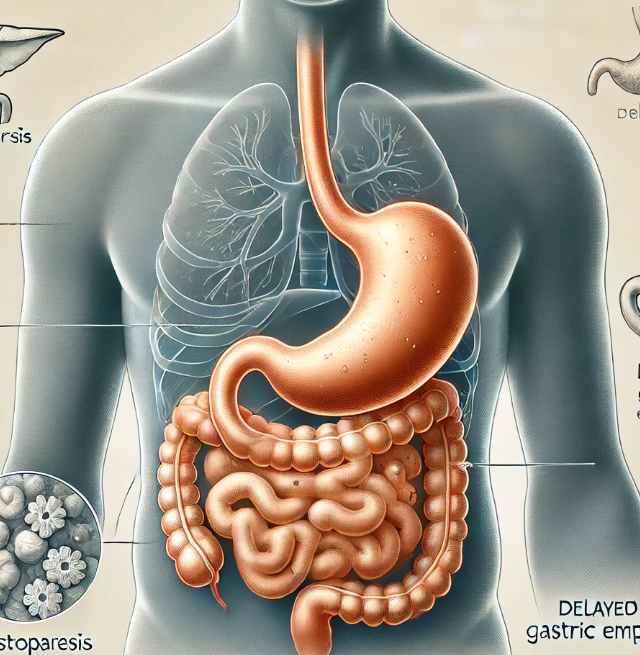 gastritis vs. gastroparesis